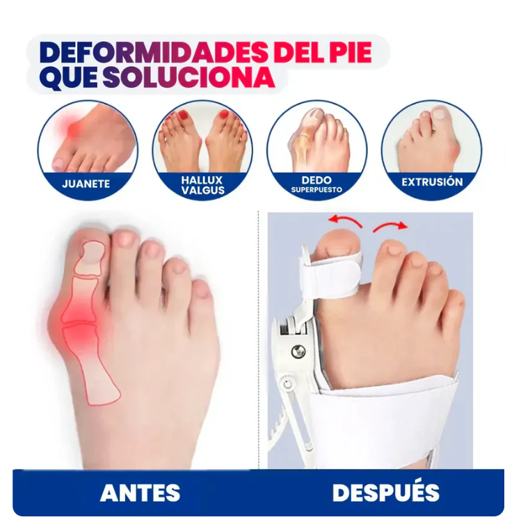 Corrector ortopédico de juanetes