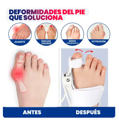 Corrector ortopédico de juanetes
